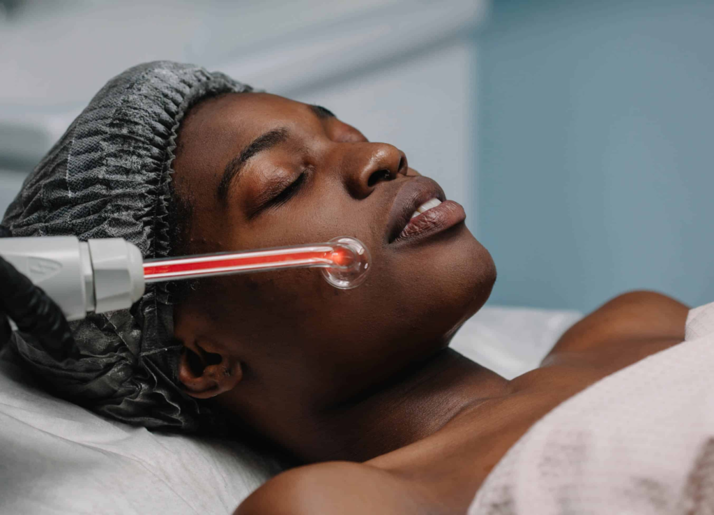 Laser For Hyperpigmentation On Black Skin