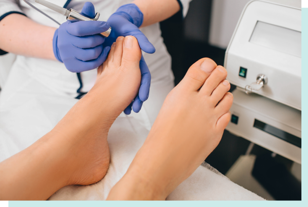 Laser For Fungal Nail Treatment