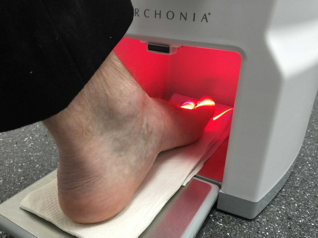 Laser For Fungal Nail