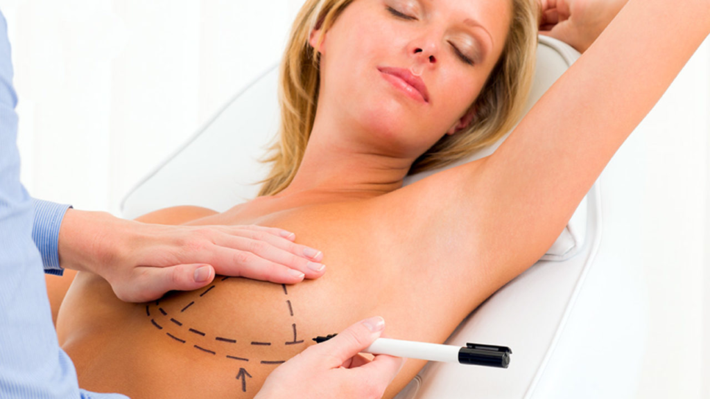 Breast Reduction Surgery Cost in Florida