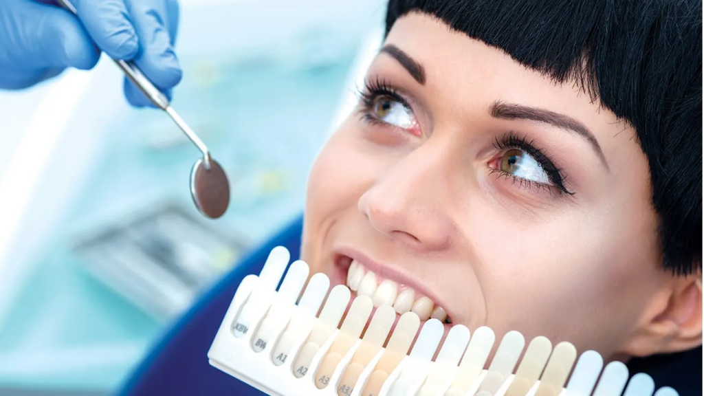 How Much Is In Office Teeth Whitening