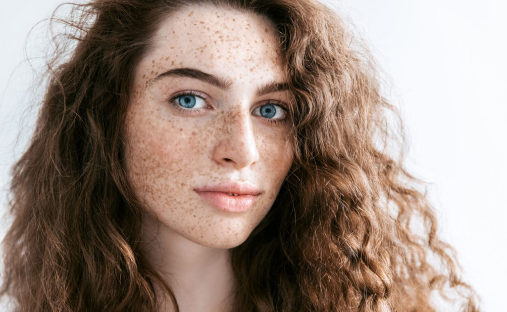 Laser For Pigmentation And Freckles