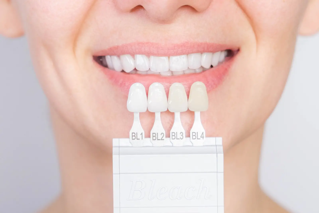 How To Use Opalescence Teeth Whitening