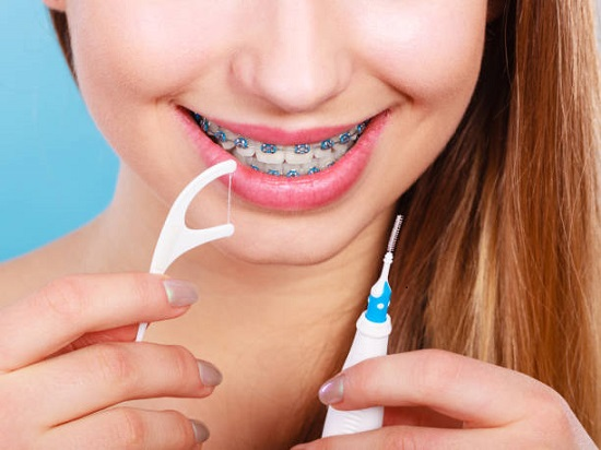 How To Use Dental Floss When You Have Braces