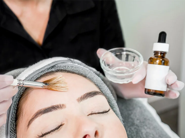 What To Know About Chemical Peel Healing