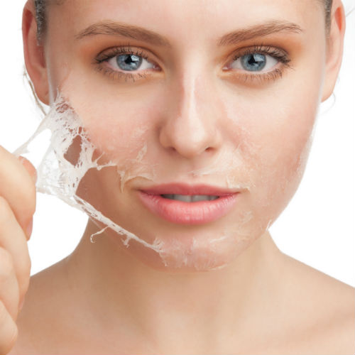 What To Know About Chemical Peel Expect