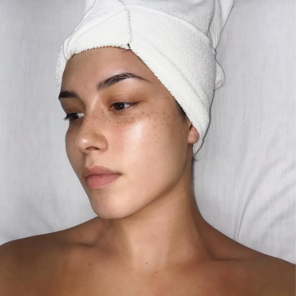 What To Know About Chemical Peel Clients