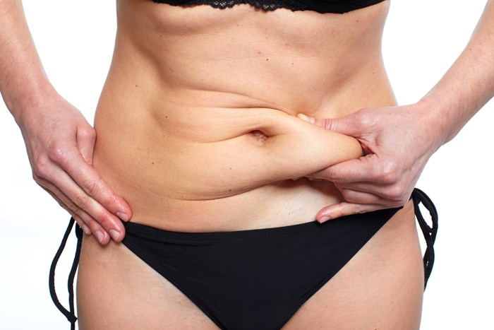 Goals Plastic Surgery Tummy Tuck