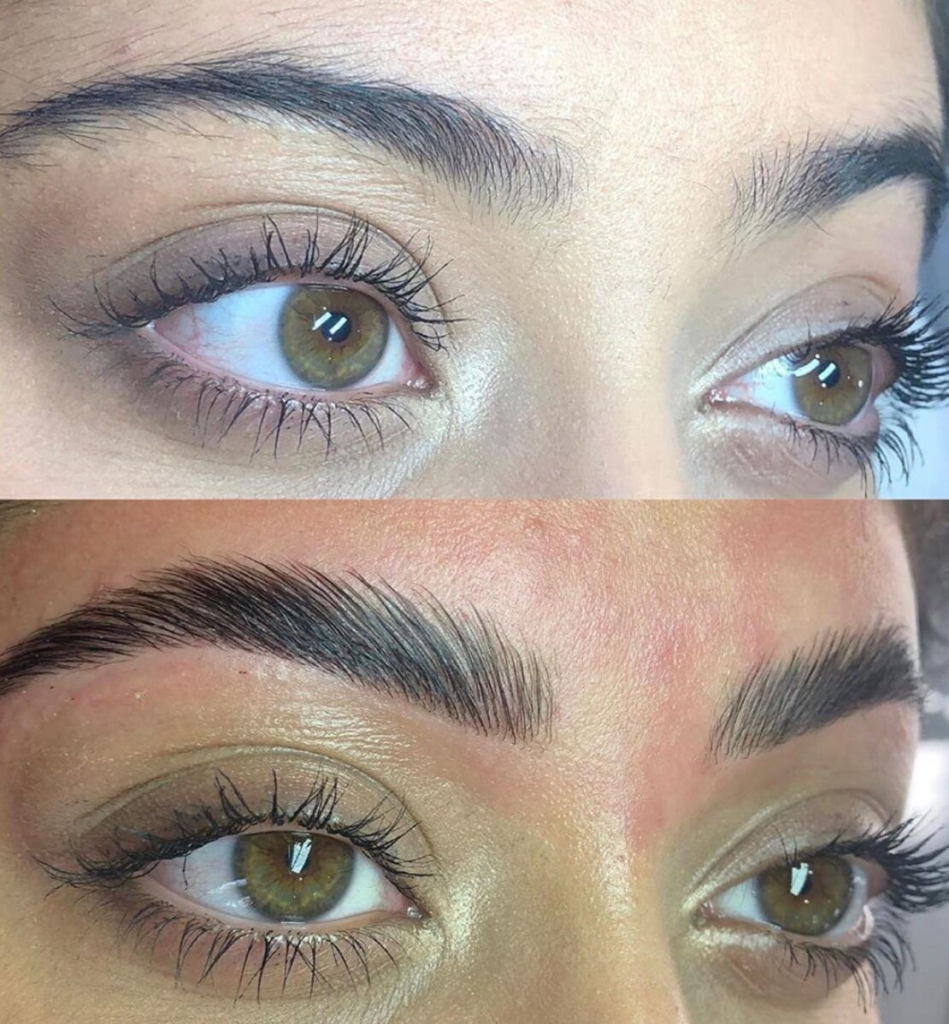 Is Brow Lift The Same As Brow Lamination