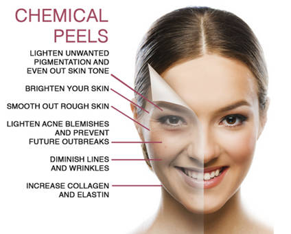 Chemical Peels: Age Requirements and Benefits
