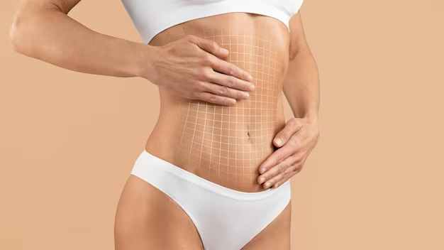 Tummy Tuck Mesh