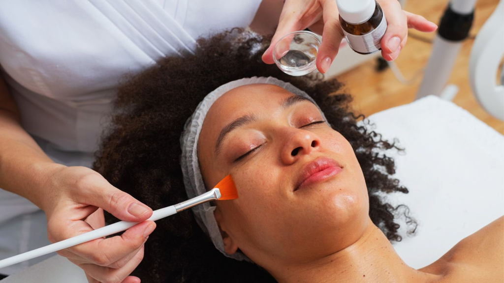 What To know Before A Chemical Peel