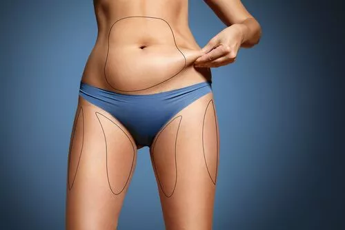 Does Liposuction Affect Fertility